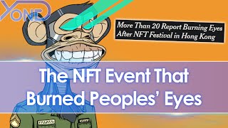 Bored Ape Sued After NFT Event Burns And Injures Attendees Eyes With UV Lights [upl. by Eimak]