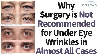 Why Under Eye Wrinkles Shouldnt be Treated with Surgery in Almost All Cases [upl. by Mason]