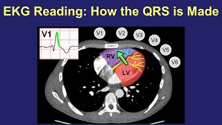 EKG Reading How the QRS is Made [upl. by David]