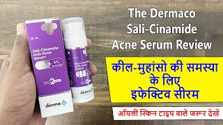 Serum for Acne Pimples  The Dermaco Sali Cinamide AntiAcne Serum Review [upl. by Ynned]