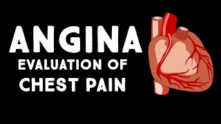 Angina Pectoris  An Approach To Chest Pain amp Acute Coronary Syndrome  Stable amp Unstable Angina [upl. by Otrepur]