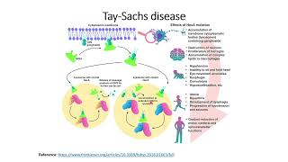 TaySachs Disease Genetic disorder Code 132 [upl. by Lashonda]