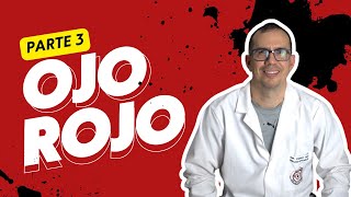 OJO ROJO Causas y Soluciones Médicas 👁🔍🔴  PARTE 3   2024 [upl. by Kayle]