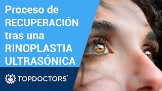 ¿Cuándo se pueden observar los resultados de la rinoplastia [upl. by Berkie129]