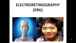 Electroretinography ERG and Electrooculography EOG [upl. by Juliana172]