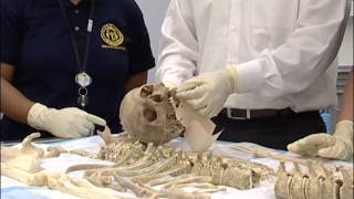 Medical Examiner System Evidence Guidelines [upl. by Krueger]