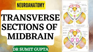 Transverse Sections of Midbrain  NEUROANATOMYTHE BRAINSTEM [upl. by Sitarski678]