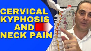 Cervical Kyphosis And Neck Pain REVERSAL CERVICAL LORDOSIS Dr Walter Salubro Chiropractor In Vaughan [upl. by Willi]