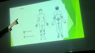 2do DERMATOLOGIA psoriasis y pitiriasis rosada 141024 [upl. by Palua]