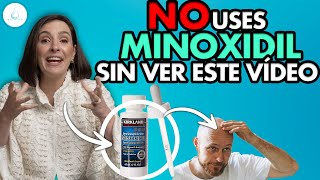 🔴 DERMATOLOGA te EXPLICA como APLICARTE MINOXIDIL ¿Efectos secundarios shedding Dra Pilar Ochoa [upl. by Neiviv]