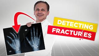 Spot Fractures Instantly 4Min AampE Masterclass [upl. by Ahsenat]