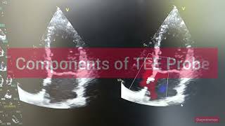 Transesophageal Echocardiography  Ultrasound TEE Probe  Echo [upl. by Cavan273]