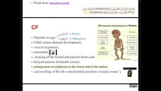 MBD4osteoporosis and osteomalacia [upl. by Hallette]