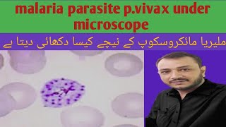 malaria under microscope plasmodium vivax under microscope [upl. by Swartz212]