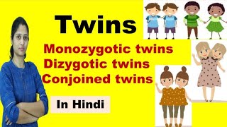 Twins  Types of Twins  Monozygotic Twins amp Dizygotic Twins  in Hindi [upl. by Him]