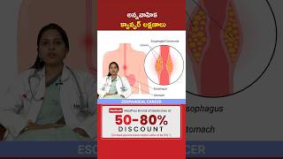 Esophageal Cancer Symptoms in 30 Sec l Dr Jyothi Jonnadula shorts MedPlusONETV [upl. by Dow182]