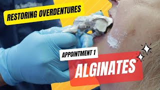 Restoring Implant Overdentures Alginate Impressions [upl. by Ycnaffit]