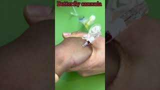 butterfly cannula kaise lagate hain shots shorts trending [upl. by Otirecul126]