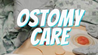 Colostomy and Ileostomy Care and Bag Change  Nurse Skill Demo [upl. by Korey]