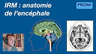 IRM  anatomie de lencéphale [upl. by Ayrad]