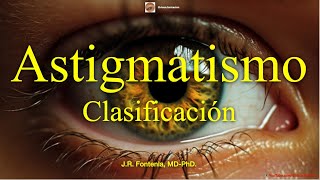 Clasificación del Astigmatismo [upl. by Mayyahk]