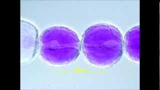 Cytoplasmic Streaming in Tradescantia Stamen Hair Cells [upl. by Coussoule]