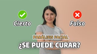 Mitos y Realidades de la Parálisis facial de Bell [upl. by Morty]