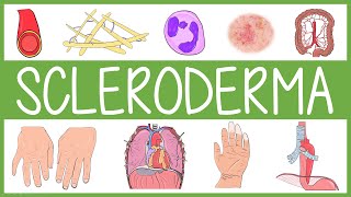 Scleroderma [upl. by Derron]