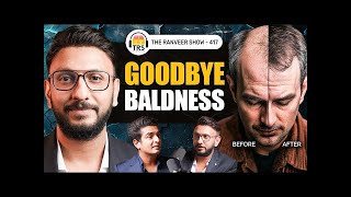 Restore Your Hairline Dermat Explains Practical Solutions To Baldness Dr Abhishek Pilani TRS417 [upl. by Arbma]