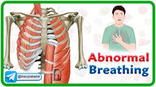 Accessory muscle Breathing Agonal Breathing Apneustic breathing Asterixis and Biots Breathing [upl. by Akihc391]