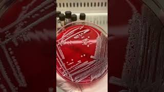 Staphylococcus aureus shorts [upl. by Schaaff]