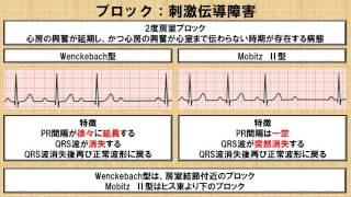 不整脈に対する心電図の読み方 ～No17 理学療法士国家試験対策 シリーズ～ [upl. by Yerac949]