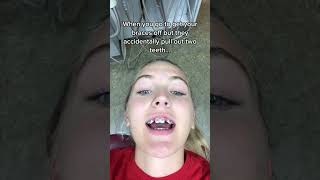 Orthodontist Reacts 2 front teeth pulled Or cap 🧢 braces [upl. by Gael]