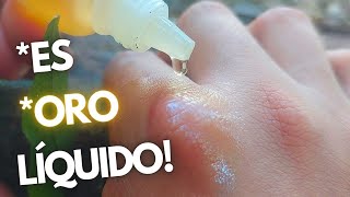 Como cicatrizar heridas de forma natural  Curar heridas desinfectar heridas  ACEITE DE COPAIBA [upl. by Euqnomod]