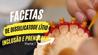 Facetas com Dissilicato de Lítio Inclusão e Prensagem [upl. by Aicetel]