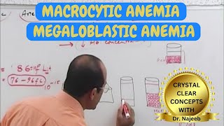 Macrocytic Anemia  Megaloblastic Anemia 🩺 [upl. by Narcho]