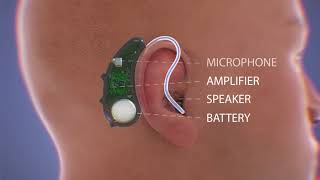 How Do Hearing Aids Work Video [upl. by Clerissa907]