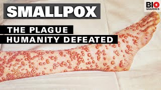 Smallpox The Plague That Humanity Defeated [upl. by Avert583]