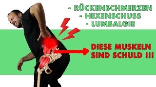 Rückenschmerzen durch blockierte Hüfte Baustellenanalyse amp Lösung [upl. by Nirrok]