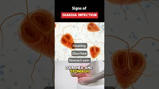 IBS Symptoms or Giardia Parasite Infection guthealth youtubeshorts shorts [upl. by Haman]