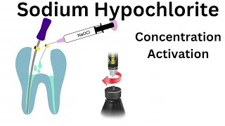 Sodium Hypochlorite Irrigation in Endodontics Part 1 Advantage Disadv Concentration amp Activation [upl. by Bilow]