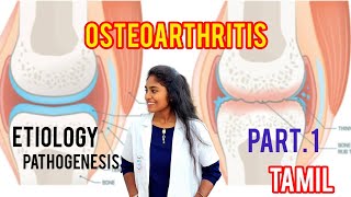 osteoarthritis  causespathophysiology clinical features part 1 in tamil [upl. by Aran]