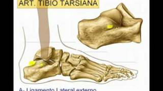 Conoce la Tobillera Strapping de DonJoy  Zona Médica [upl. by Annice517]