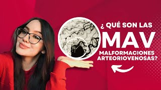 ¿Qué son las MAV Malformaciones Arteriovenosas Causas Síntomas y Tratamientos [upl. by Bodwell656]