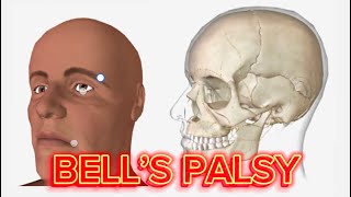 Bells Palsy Understanding Symptoms Causes amp Recovery  Facial Nerve Paralysis Explained [upl. by Inge]