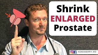 Shrink ENLARGED PROSTATE in 7 Easy Steps 2024 Update [upl. by Rebmaed641]