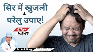 सिर में खुजली  5 बड़े कारण  Itchy Scalp Problem  Treatment  Head Itches Even After Washing Hair [upl. by Saxena]