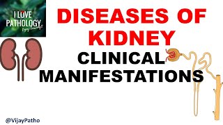 RENAL PATHOLOGY Part 1  Clinical Manifestations [upl. by Orgell]