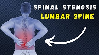 Spinal Stenosis daily exercises for pain relief [upl. by Ened]