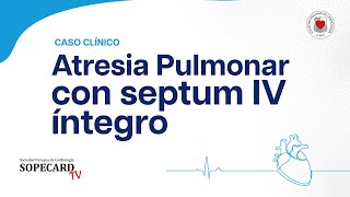 Cardiología  Caso Clínico Atresia Pulmonar con septum IV íntegro  SOPECARD TV [upl. by Harmon]